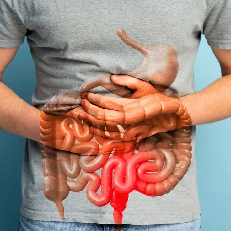 SAPHIRA™ - GUT SUPPORT CAPSULE