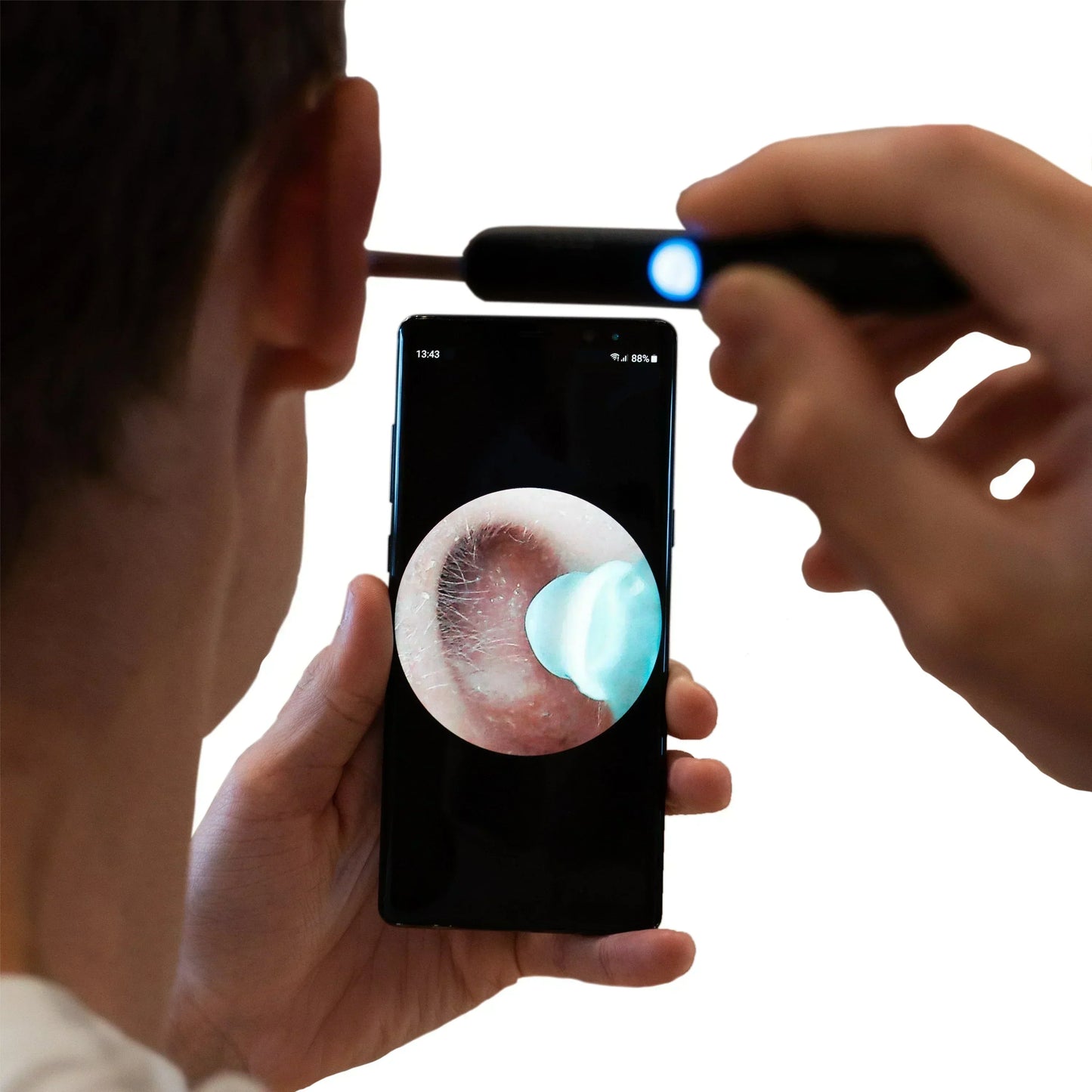 SAPHIRA™   - PROFESSIONAL EAR WAX REMOVAL TOOL